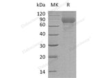 Recombinant Mouse TEM7R/PLXDC2 Protein (His Tag)