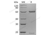 Recombinant Mouse PCSK9/NARC1 Protein (His Tag)