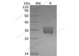 Recombinant Mouse CREG/CREG1 Protein (His Tag)