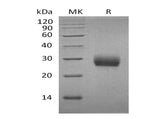 Recombinant Mouse RANK/TNFRSF11A Protein (His Tag)