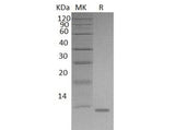 Recombinant Mouse S100A8/CAGA Protein (His Tag)