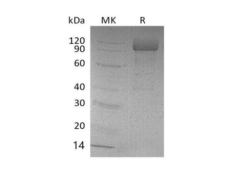 Recombinant Mouse SCARB2/LIMPII Protein (His Tag)