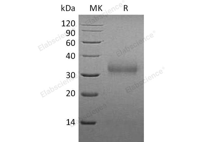 Recombinant Mouse Sclerostin/SOST Protein (His Tag)