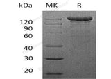 Recombinant Mouse Semaphorin-4C/SEMA4C Protein (Fc Tag)