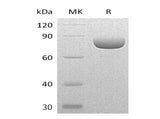 Recombinant Mouse Semaphorin-4A/SEMA4A Protein (His Tag)