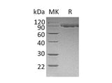 Recombinant Mouse Serpin G1/C1IN Protein (His Tag)