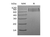 Recombinant Mouse SIRPA/CD172a Protein (His Tag) 