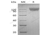 Recombinant Mouse SIRPA/CD172a Protein (Fc Tag)
