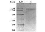 Recombinant Mouse SIRPA/CD172a Protein (MIgG2a Tag) 