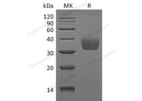 Recombinant Mouse SLAMF8 Protein (His Tag)