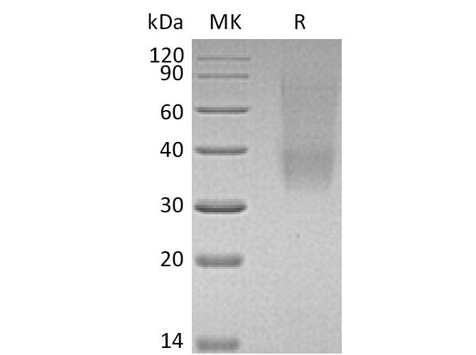 Recombinant Mouse SLAMF9 Protein (His Tag)