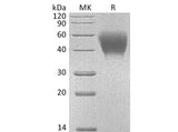Recombinant Mouse CD150/SLAM Protein (His Tag)