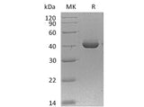 Recombinant Mouse TNFRSF13B/TACI/CD267 Protein (Fc Tag)