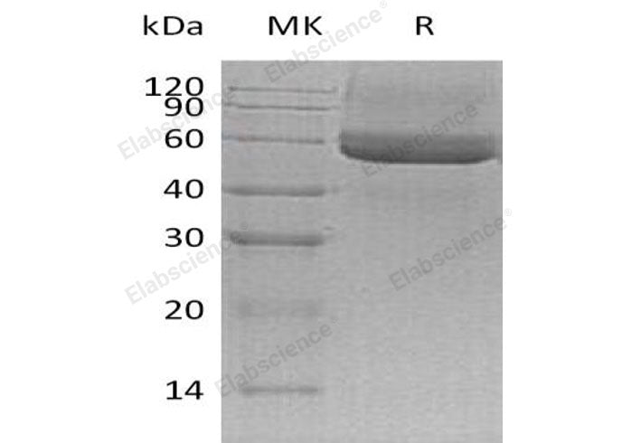 Recombinant Mouse Testican-3/SPOCK3 Protein (His Tag)