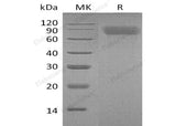Recombinant Mouse Thrombopoietin/TPO Protein (His Tag)