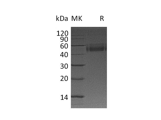 Recombinant Mouse TSLP Protein (Fc Tag)