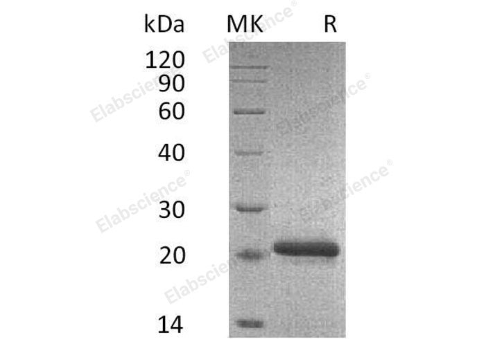 Recombinant Mouse TIMP2/TIMP-2 Protein (His Tag)