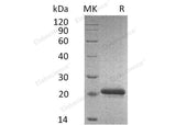 Recombinant Mouse TIMP2/TIMP-2 Protein (His Tag)