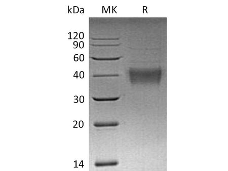 Recombinant Mouse TNFSF9 Protein (His Tag) (Active)