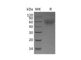 Recombinant Mouse CD30/TNFRSF8 Protein (His Tag)