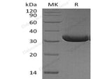 Recombinant Mouse RANKL/TNFSF11 Protein (His Tag)(Active)