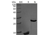 Recombinant Mouse TGFβ1/TGFB1 Protein (Active)