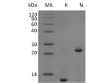 Recombinant Mouse TGFB2 Protein (Active)