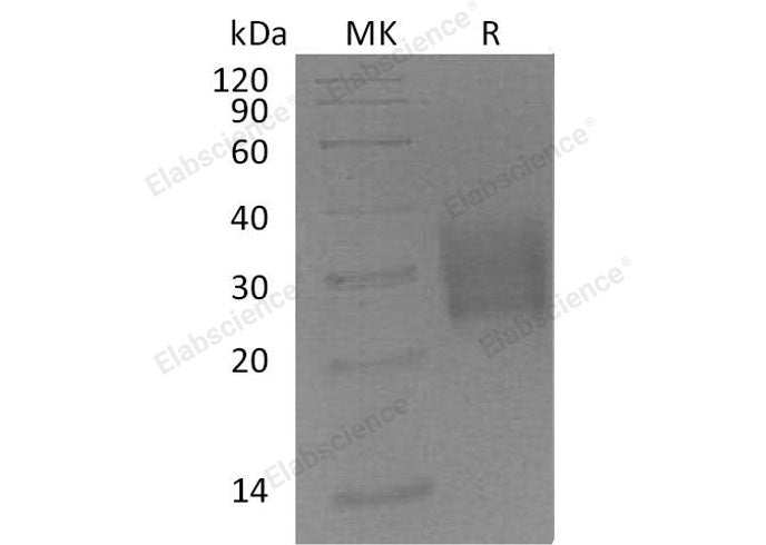 Recombinant Mouse TGFBR2 Protein (His Tag)