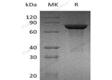 Recombinant Mouse TGM2/Transglutaminase 2 Protein (His Tag)