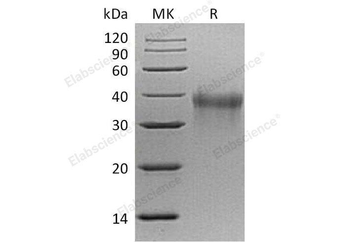 Recombinant Mouse TREM1 Protein (His Tag)