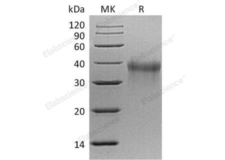 Recombinant Mouse TREM1 Protein (His Tag)