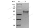 Recombinant Mouse TREM1 Protein (His Tag)