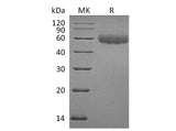 Recombinant Mouse TREML2/TLT2 Protein (His Tag)