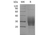 Recombinant Mouse TREM2 Protein (His Tag)