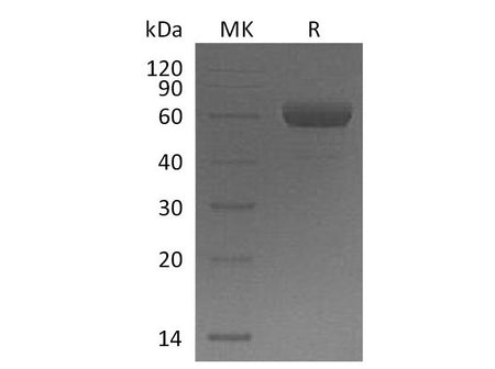 Recombinant Mouse TREM2 Protein (Fc Tag)