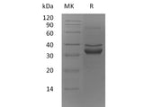 Recombinant Mouse FN14/TWEAKR Protein (Fc Tag)