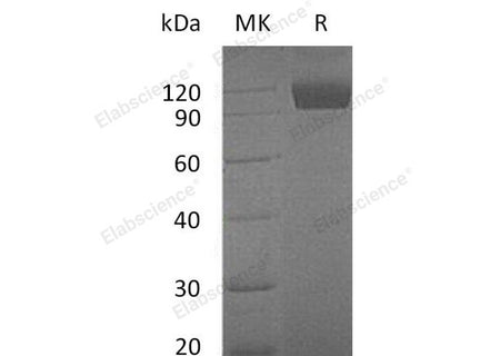 Recombinant Mouse TYRO3/DTK Protein (Fc Tag)