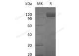 Recombinant Mouse TYRO3/DTK Protein (Fc Tag)