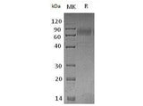 Recombinant Mouse TYRO3/DTK Protein (mFc Tag)