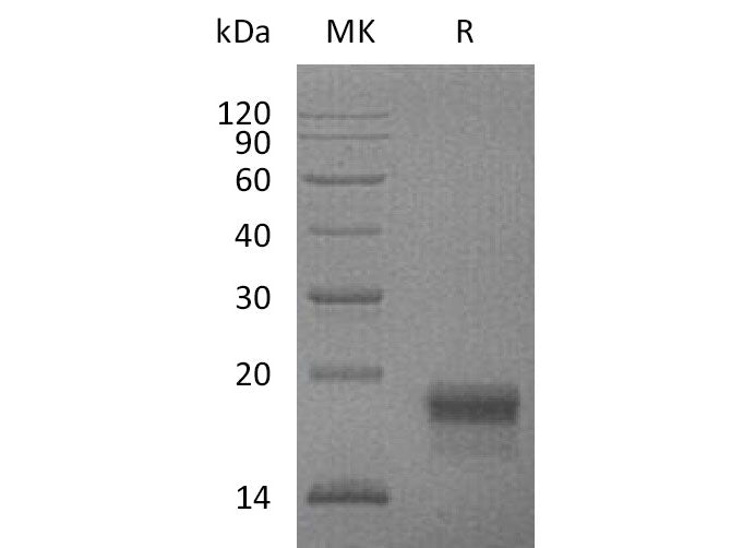 Recombinant Mouse VEGF-D/VEGFD Protein (His Tag)