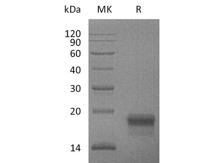 Recombinant Mouse VEGF-D/VEGFD Protein (His Tag)