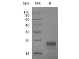 Recombinant Mouse VEGF-D/VEGFD Protein (His Tag)