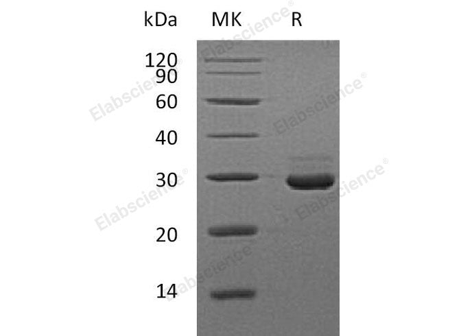 Recombinant Mouse VSIG8 Protein (His Tag)