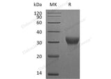 Recombinant Mouse VSIG4 Protein (His Tag)