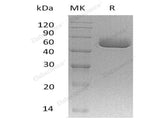 Recombinant Mouse Serpina A1a Protein (His Tag)