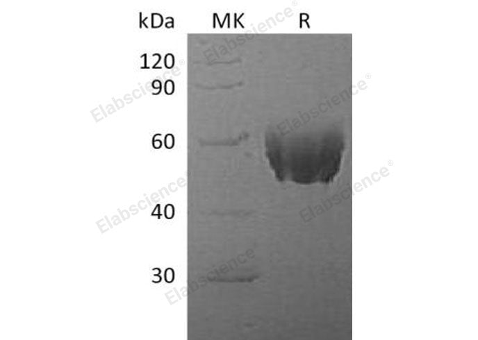 Recombinant Mouse Fetuin-A/AHSG Protein (His Tag)