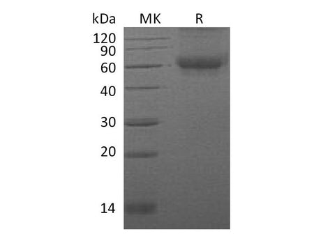 Recombinant Mouse DDR2 Kinase/CD167b Protein (His Tag)