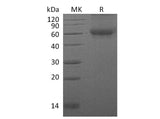 Recombinant Mouse DDR2 Kinase/CD167b Protein (His Tag)