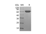 Recombinant Mouse Legumain/LGMN Protein (His Tag)