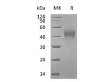 Recombinant Mouse TIM-3/HAVCR2 Protein (aa 20-193, His Tag)